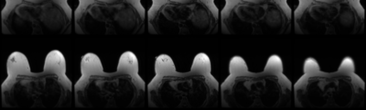 Image Placeholder
